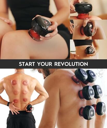 REVOMADIC REVO The Original 4-in-1 Smart Cupping Therapy Massager, Red Light Therapy for Targeted Pain Relief, Knots, Aches, Muscle Soreness, Circulation & Tighter Skin, Portable Cupping Kit