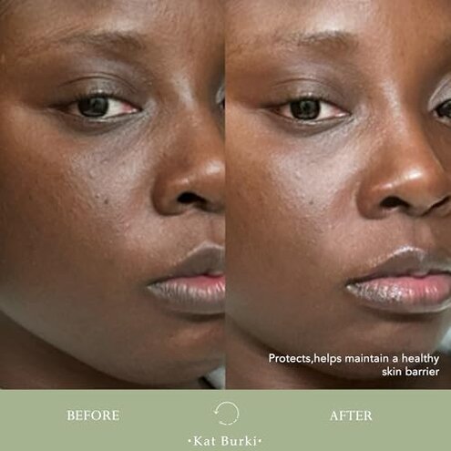 KAT BURKI KB5 Calming Gel Cleanser, Gentle Moisturizing Face Wash & Makeup Remover With Hydrating Botanicals for Sensitive Skin, 4.4 Fl Oz