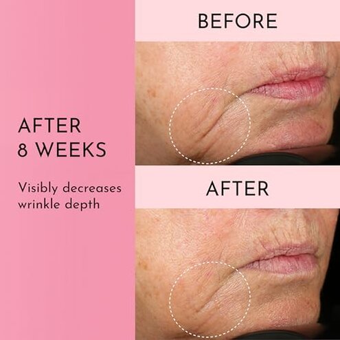 Lawless Forget the Filler Skin-Plumping Line-Smoothing Perfecting Cream - Premium Non-Acne Moisturizer Designed to Prime, Plump, Smooth, and Tighten Skin for a Youthful, Hydrating Look - 1.7 oz