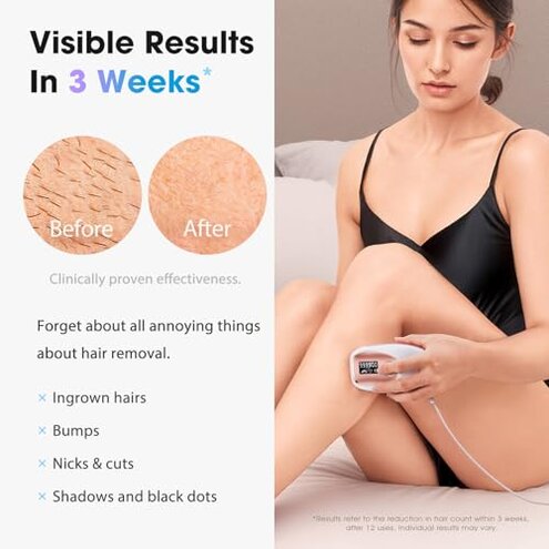Oreeth IPL Laser Hair Removal Device for Women & Men - Home 45&deg;F Ice-Cooling Contact for Painless & Long-Lasting Results, 86% Hair Reduction in 3 Weeks for Full Body & Bikini Line, Rose Gold