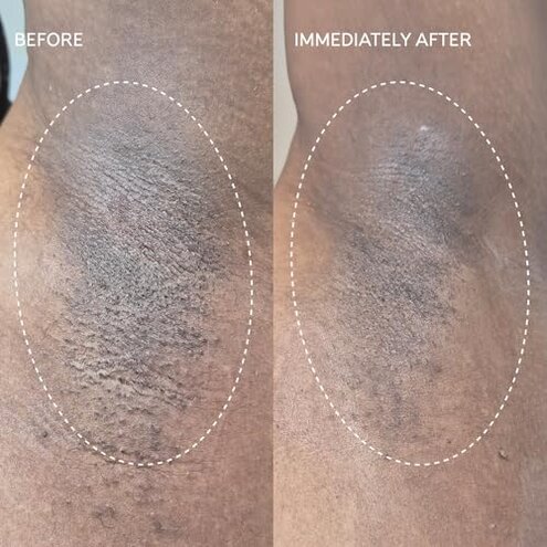 Fur Flash Repair Jelly &ndash; Hypochlorous Acid Aftercare Gel for Post-Wax, Shave, or Laser &ndash; Soothes Redness, Bumps, and Irritation Dermatologist-Tested, Fragrance-Free (2.0 fl oz / 60mL)