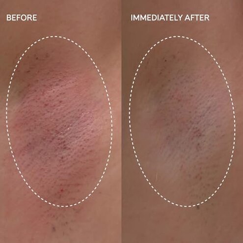 Fur Flash Repair Jelly &ndash; Hypochlorous Acid Aftercare Gel for Post-Wax, Shave, or Laser &ndash; Soothes Redness, Bumps, and Irritation Dermatologist-Tested, Fragrance-Free (2.0 fl oz / 60mL)